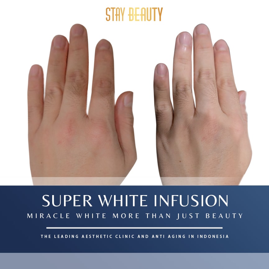 SUPER WHITE INFUSION-min