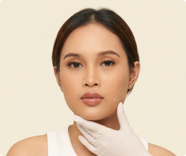 THREADLIFT NOSE