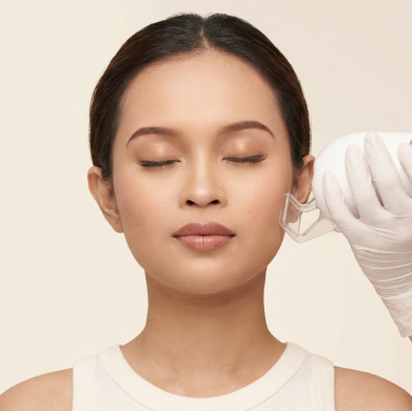 ACNE SCAR LASER