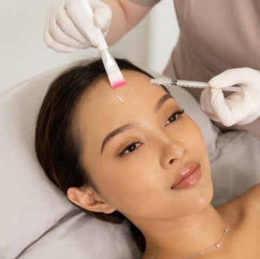 Acne Facial and Peeling