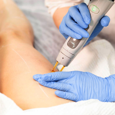 Body Laser
