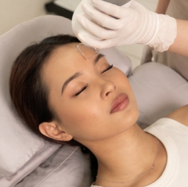 FRACTIONAL LASER