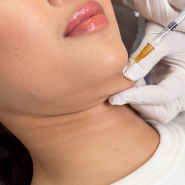 LIPO MAX Slimming Treatment