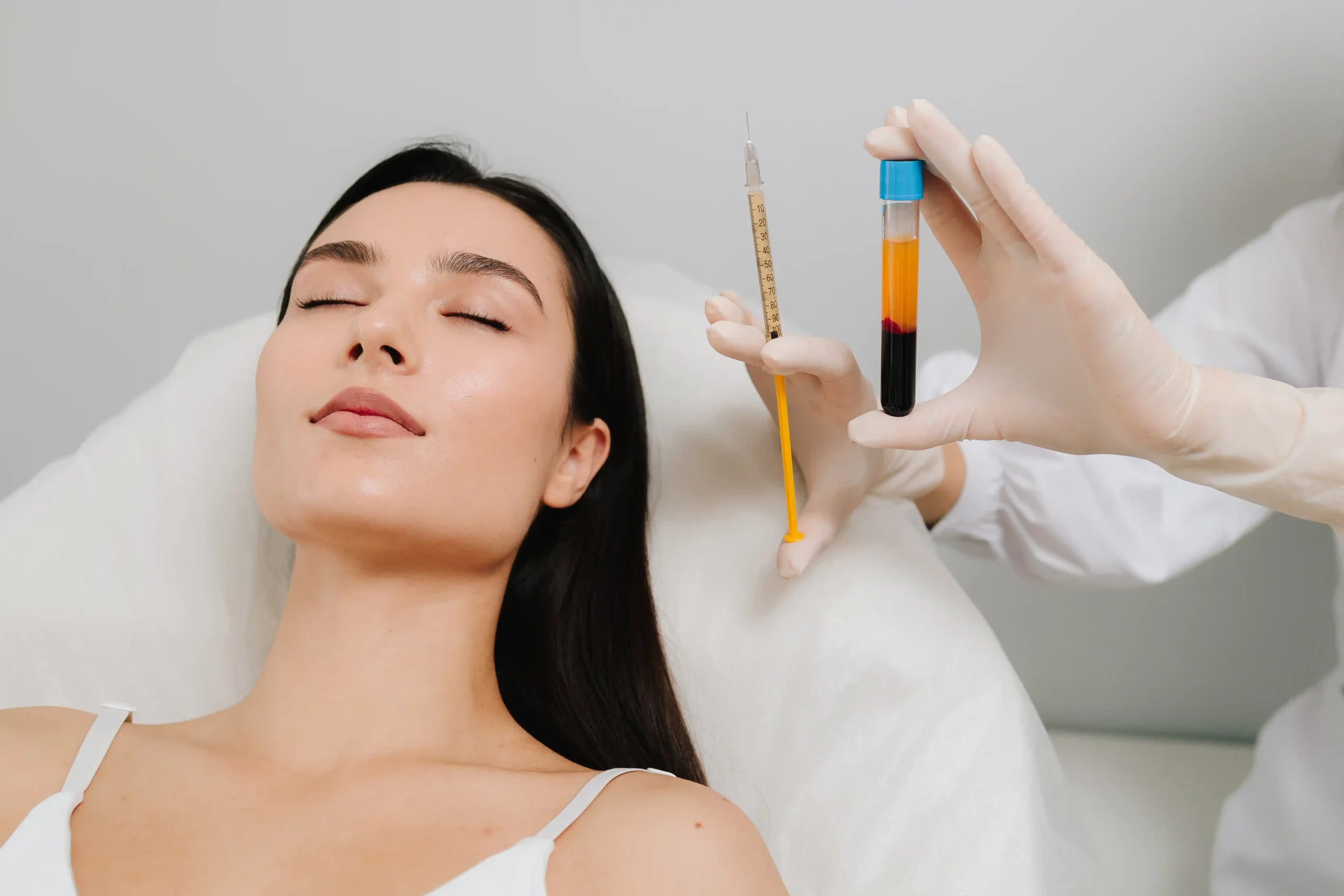 PRP Treatment