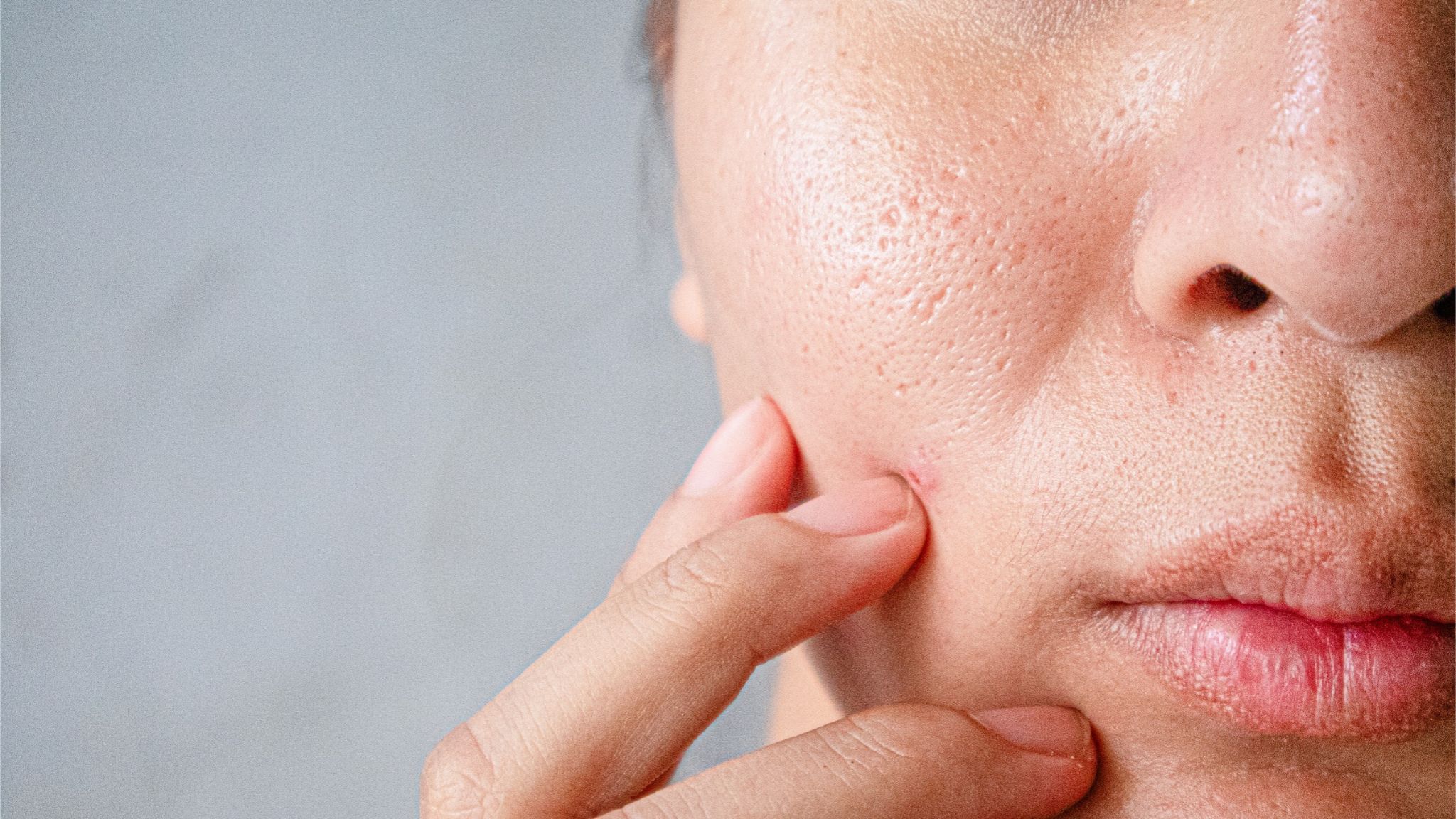 Cara Mengecilkan Pori-pori Wajah