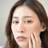 13 Cara untuk Menghilangkan Flek Hitam di Wajah